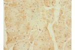 Immunohistochemistry of paraffin-embedded human heart tissue CSB-PA753708LA01HU at dilution 1:100