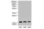 Western blot<br />
All lanes: CNIH2 antibody at 2ug/ml<br />
Lane 1 : U251 whole cell lysate<br />
Lane 2 : Mouse liver tissue<br />
Lane 3 : Mouse kidney tissue<br />
Secondary<br />
Goat polyclonal to Rabbit IgG at 1/10000 dilution<br />
Predicted band 