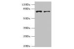 Western blot<br />
All lanes:GBE1 antibody at 3.13ug/ml<br />
Lane 1:HepG2 whole cell lysate<br />
Lane 2:Hela whole cell lysate<br />
Secondary<br />
Goat polyclonal to rabbit at 1/10000 dilution<br />
Predicted band size: 80kDa<br />
Observed band size: