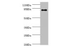 Western blot<br />
All lanes:GBE1 antibody at 3.13ug/ml+mouse liver tissue<br />
Secondary<br />
Goat polyclonal to rabbit at 1/10000 dilution<br />
predicted band size 80kDa<br />
Observed band size: 80kDa<br />