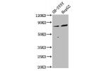 Western Blot<br />
Positive WB detected in:SH-SY5Y whole cell lysate,HepG2 whole cell lysate<br />
All lanes:DPY19L3 antibody at 3.4