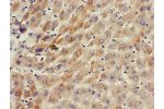 Immunohistochemistry of paraffin-embedded human liver tissue using CSB-PA754597LA01HU at dilution of 1:100