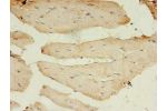 Immunohistochemistry of paraffin-embedded human Skeletal muscle using CSB-PA755482LA01HU at dilution of 1:100