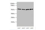 Western blot<br />
All lanes: ARMCX2 antibody at 5ug/ml<br />
Lane 1 : Mouse brain tissue<br />
Lane 2 : HepG-2 whole cell lysate<br />
Lane 3 : HCT116 whole cell lysate<br />
Lane 4 : MCF7 whole cell lysate<br />
Secondary<br />
Goat polyclonal to Rabbit