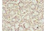 Immunohistochemistry of paraffin-embedded human rectum tissue using CSB-PA757108LA01HU at dilution of 1:100