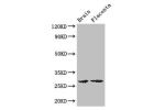 Western Blot<br />
Positive WB detected in:Mouse brain tissue,Human placenta tissue<br />
All lanes: FBXL22 antibody at 3ug/ml<br />
Secondary<br />
Goat polyclonal to rabbit IgG at 1/50000 dilution<br />
Predicted band size: 28 kDa<br />
Observed band si
