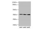 Western blot<br />
All lanes: FOXR2 antibody at 4ug/ml<br />
Lane 1 : SH-SY5Y whole cell lysate<br />
Lane 2 : Jurkat whole cell lysate<br />
Lane 3 : Hela whole cell lysate<br />
Secondary<br />
Goat polyclonal to Rabbit IgG at 1/10000 dilution<br />
Pre
