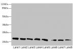 Western blot<br />
All lanes: C19orf80 antibody at 6ug/ml<br />
Lane 1 : Mouse liver tissue<br />
Lane 2 : LO2 whole cell lysate<br />
Lane 3 : HepG-2 whole cell lysate<br />
Lane 4 : A549 whole cell lysate<br />
Lane 5 : Caco-2 whole cell lysate<br />
La
