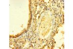 Immunohistochemistry of paraffin-embedded human lung tissue using CSB-PA757939LA01HU at dilution of 1:100