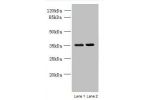 Western blot<br />
All lanes: CCDC108 antibody at 8ug/ml<br />
Lane 1 : U251 whole cell lysate<br />
Lane 2 : U87 whole cell lysate<br />
Secondary<br />
Goat polyclonal to Rabbit IgG at 1/10000 dilution<br />
Predicted band size: 218,19,82,88 kDa<br />
O