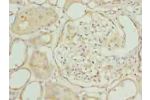 Immunohistochemistry of paraffin-embedded human kidney tissue using CSB-PA759172LA01HU at dilution of 1:100