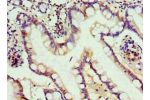 Immunohistochemistry of paraffin-embedded human small intestine using CSB-PA761219ESR1HU at dilution 1:100