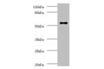 Western blot<br />
All lanes:Uncharacterized aarF domain-containing protein kinase 2 antibody at 2ug/ml+K562 whole cell lysate<br />
Secondary<br />
Goat polyclonal to Rabbit IgG at 1/15000 dilution<br />
Predicted band size: 69kDa<br />
Observed band siz