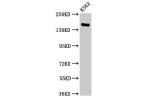 Western Blot<br />
Positive WB detected in:K562 whole cell lysate<br />
All lanes:FGD6 antibody at 2.8