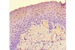 Immunohistochemistry of paraffin-embedded human tonsil tissue using CSB-PA762572LA01HU at dilution of 1:100