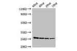 Western Blot<br />
Positive WB detected in Recombinant protein<br />
All lanes:esxA antibody at 2.8