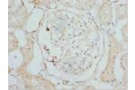 Immunohistochemistry of paraffin-embedded Human kidney tissue using CSB-PA765094ESR1HU at dilution 1:100