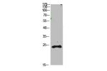Western Blot analysis of 1,mouse-kidney cells using primary antibody diluted at 1:1000(4