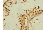 Immunohistochemistry of paraffin-embedded human testis tissue CSB-PA767207ESR1HU at dilution 1:100