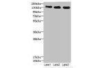 Western blot<br />
All lanes: ANKS1B antibody at 5.28ug/ml<br />
Lane 1 : 293T whole cell lysate<br />
Lane 2 : HepG-2 whole cell lysate<br />
Lane 3 : Hela whole cell lysate<br />
Secondary<br />
Goat polyclonal to rabbit IgG at 1/10000 dilution<br />
Pr