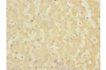 Immunohistochemistry of paraffin-embedded human liver tissue CSB-PA768200ESR2HU at dilution 1:100
