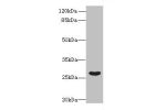 Western blot<br />
All lanes: FAM122B antibody at 5ug/ml+Mouse brain tissue<br />
Goat polyclonal to rabbit at 1/10000 dilution<br />
Predicted band size: 27,28,30,20 kDa<br />
Observed band size: 27 kDa<br />