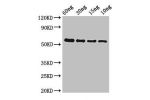 Western Blot<br />
Positive WB detected in Recombinant protein<br />
All lanes:gelE antibody at 2