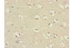 Immunohistochemistry of paraffin-embedded human brain tissue using CSB-PA769805DSR1HU at dilution of 1:100