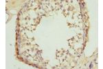 Immunohistochemistry of paraffin-embedded human testis tissue using CSB-PA770347ESR1HU at dilution 1:100