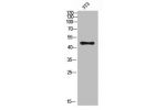 Western Blot analysis of 3T3 cells using Antibody diluted at 500. Secondary antibody  was diluted at 1:20000