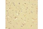 Immunohistochemistry of paraffin-embedded human brain tissue using CSB-PA772019LA01HU at dilution 1:100
