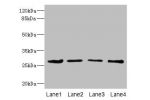Western blot<br />
All lanes: DCXR antibody at 2.93ug/ml<br />
Lane 1 : Mouse gonadal tissue<br />
Lane 2 : HepG-2 whole cell lysate<br />
Lane 3 : A431 whole cell lysate<br />
Lane 4 : MCF7 whole cell lysate<br />
Goat polyclonal to Rabbit IgG at 1/10000