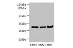 Western blot<br />
All lanes: DCXR antibody at 2.23ug/ml<br />
Lane 1 : Mouse lung tissue<br />
Lane 2 : Mouse liver tissue<br />
Lane 3 : Mouse gonadal tissue<br />
 Goat polyclonal to Rabbit IgG at 1/10000 dilution<br />
Predicted band size: 26 kDa<br /