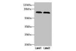Western blot<br />
All lanes: GALNT7 antibody at 0.1ug/ml<br />
Lane 1 : Hela whole cell lysate<br />
Lane 2 : HepG-2 whole cell lysate<br />
Secondary<br />
Goat polyclonal to Rabbit IgG at 1/10000 dilution<br />
Predicted band size: 75 kDa<br />
Observe