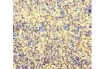 Immunohistochemistry of paraffin-embedded human spleen tissue using CSB-PA773048LA01HU at dilution of 1:100