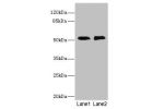 Western blot<br />
All lanes: TMOD1 antibody at 2.84ug/ml<br />
Lane 1 : PC-3 whole cell lysate<br />
Lane 2 : 293T whole cell lysate<br />
Secondary<br />
Goat polyclonal to rabbit IgG at 1/10000 dilution<br />
Predicted band size: 53,24 kDa<br />
Observ