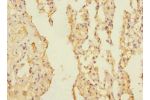 Immunohistochemistry of paraffin-embedded human lung tissue using CSB-PA773051DSR2HU at dilution 1:100