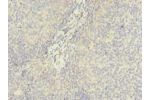 Immunohistochemistry of paraffin-embedded human tonsil using CSB-PA773053LA01HU at dilution of 1:100
