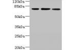 Western blot<br />
All lanes: ARMC9 antibody at 6ug/ml<br />
Lane 1 : Jurkat whole cell lysate<br />
Lane 2 : CEM whole cell lysate<br />
Lane 3 : A549 whole cell lysate<br />
Secondary<br />
Goat polyclonal to Rabbit IgG at 1/10000 dilution<br />
Predict
