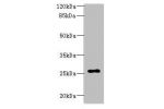 Western blot<br />
All lanes: ARPIN antibody at 0.5ug/ml+HepG-2 whole cell lysate<br />
Goat polyclonal to rabbit at 1/10000 dilution<br />
Predicted band size: 25,44 kDa<br />
Observed band size: 25 kDa<br />