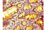 Immunohistochemistry of paraffin-embedded human small intestine tissue using CSB-PA774811LA01HU at dilution of 1:100