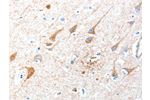 The image on the left is immunohistochemistry of paraffin-embedded Human brain tissue using CSB-PA775649(AKT3 Antibody) at dilution 1/40, on the right is treated with synthetic peptide. (Original magnification: 
