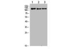 Western Blot analysis of 1,mouse-liver 2,hela 3,mouse-brain cells using primary antibody diluted at 1:1000(4