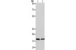 Gel: 12+15%SDS-PAGE, Lysate: 40 