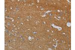 The image on the left is immunohistochemistry of paraffin-embedded Human brain tissue using CSB-PA780265(DPYSL3 Antibody) at dilution 1/20, on the right is treated with synthetic peptide. (Original magnification: 