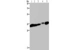 Gel: 10%SDS-PAGE, Lysate: 40 
