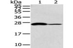 Gel: 12%SDS-PAGE, Lysate: 40 
