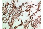 Immunohistochemical analysis of paraffin-embedded human-lung, antibody was diluted at 1:200