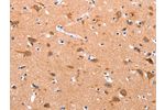 The image on the left is immunohistochemistry of paraffin-embedded Human brain tissue using CSB-PA783095(APAF1 Antibody) at dilution 1/30, on the right is treated with synthetic peptide. (Original magnification: 