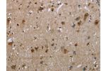 The image on the left is immunohistochemistry of paraffin-embedded Human brain tissue using CSB-PA784072(EGFL8 Antibody) at dilution 1/30, on the right is treated with fusion protein. (Original magnification: 